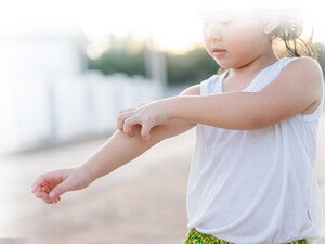 Waspada Alergi Pada Si Kecil