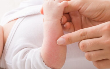 Cara Mencegah Alergi Pada Bayi dengan Tepat (1).jpg
