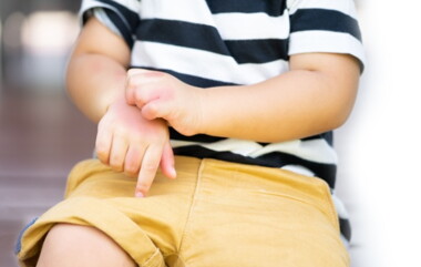 Penyebab dan Cara Mengatasi Gatal Pada Bayi Thumbnail.jpg