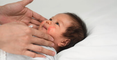 Penyebab Kulit Bayi Merah dan Cara Mengatasinya     