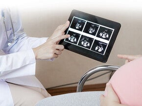 Mengenal 4 Jenis Pemeriksaan Kehamilan