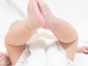 Penyebab dan Cara Mengatasi Jamur Pada Kemaluan Bayi  