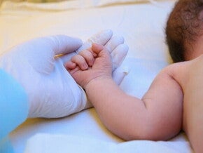 Cara Mencegah Bayi Kuning: Ini Langkah-Langkah Penting