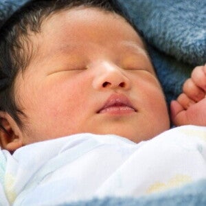 penyakit kuning pada bayi penyakit kuning pada bayi