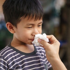 10 Penyebab Mimisan pada Anak dan Cara Mengatasinya