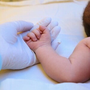 Cara Mencegah Bayi Kuning: Ini Langkah-Langkah Penting Cara Mencegah Bayi Kuning: Ini Langkah-Langkah Penting