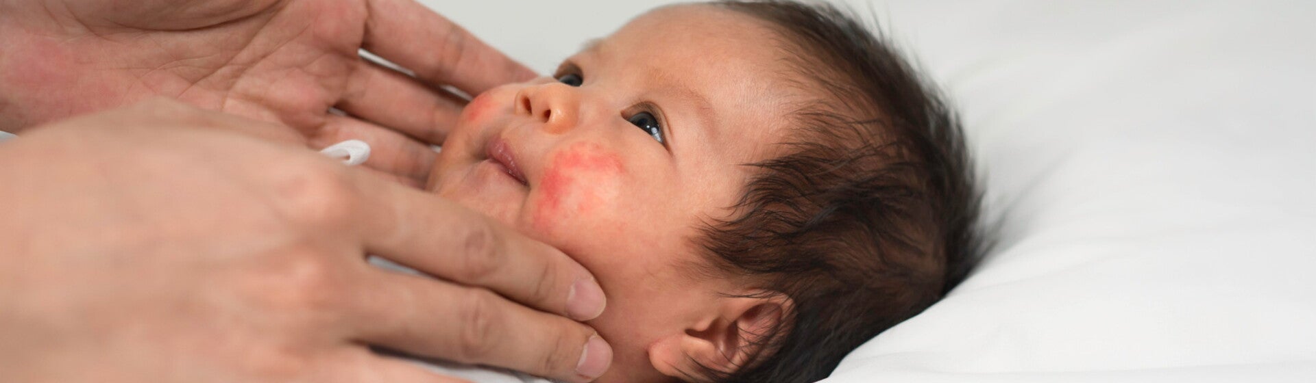 Penyebab Kulit Bayi Merah dan Cara Mengatasinya.jpg Penyebab Kulit Bayi Merah dan Cara Mengatasinya.jpg